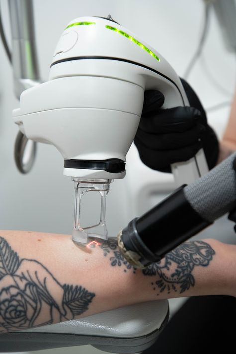 Tattoo removal laser about to begin on an arm tattoo. Tatto Designs, Remove Tattoo, Pico Laser, Laser Clinic, Tattoo Minimal, Omerta Tattoo, Website Photos, Famous Tattoos, Intricate Tattoo