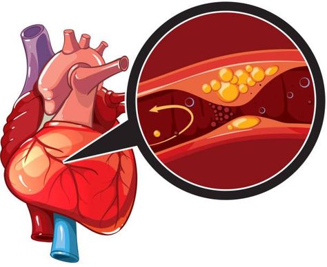 Vascular Surgery, Heart Valves, Congenital Heart Defect, Heart Palpitations, Chronic Obstructive Pulmonary Disease, Heart Function, Coronary Arteries, Pulmonary Disease, Healthy Heart