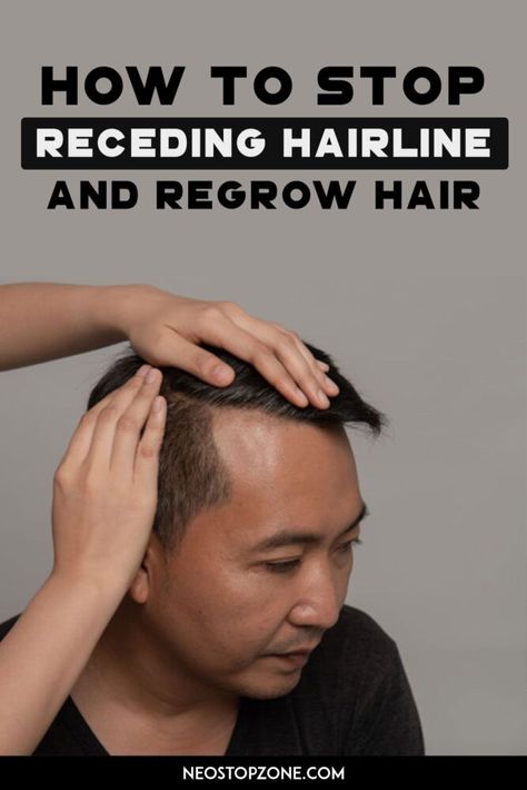 How to Stop  Receding Hairline (male pattern baldness) and regrow hair Regrow Hairline, Men Hairline, Haircuts For Receding Hairline, Hairstyles For Receding Hairline, Regrow Hair Naturally, Receding Hair Styles, New Hair Do, Hairstyle For Men, How To Grow Your Hair Faster