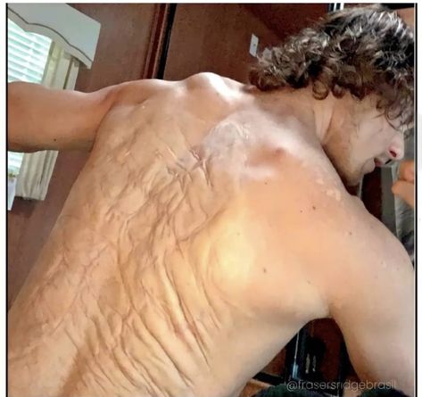 How To Draw Scars, Outlander Jamie, Face Reference, Jamie Fraser, Anatomy Reference, Body Poses, Anatomy Art, Photo Reference, Art Tips