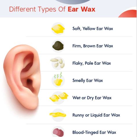 Clogged Ear Remedy, Clean Ear Wax Out, Impacted Ear Wax, Blocked Ears, Ear Cleaning Wax, Clogged Ears, Ear Wax Buildup, Ear Candling, Medical Herbs