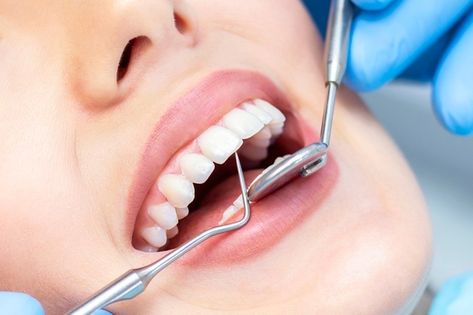 Female at dentist for teeth examination ... | Premium Photo #Freepik #photo #woman #medical #smile #dental Dental Pictures, Dental Photos, Dental Images, Remedies For Tooth Ache, Dental Check Up, Kedokteran Gigi, Dental Photography, Wisdom Teeth Removal, Emergency Dentist