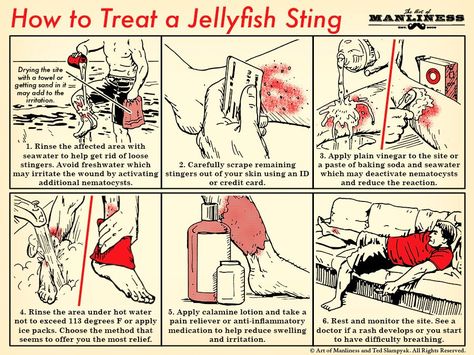 If you’re stung by a jellyfish, ignore the urge to urinate on it because you saw it on a TV show. Treat your sting correctly with these simple steps. Jellyfish Sting, 1000 Lifehacks, Art Of Manliness, Survival Life Hacks, Survival Techniques, Survival Life, Wilderness Survival, About Money, Camping Survival