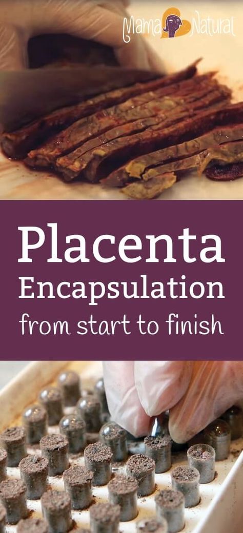 Placenta Encapsulation Benefits, Placenta Recipes, Placenta Pills, Roots Book, Placenta Encapsulation, Unmedicated Birth, Water Birth, Postpartum Doula, Birth Doula