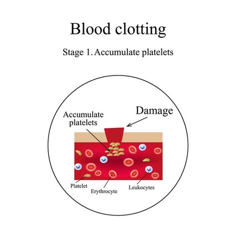 von Willebrand Disease Von Willebrand Disease, Medical School Studying, Health Information, White Blood Cells, Red Blood Cells, Natural Therapy, Medical School, Disease, All In One