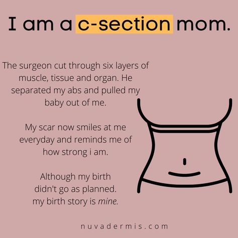 Cesarean Section Quotes, C Section Affirmations, Baby Momma Quotes, Momma Quotes, Fertility Cycle, Pregnancy Facts, C Section Recovery, Cesarean Section, Pregnancy Info