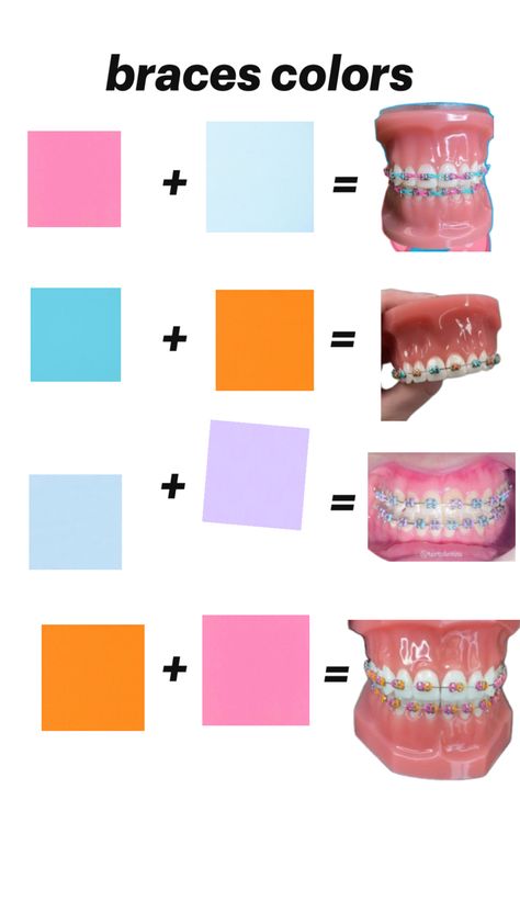 inspirational Best Braces Colors, Dental Braces Colors, Braces Colors Combinations, Pink Braces, Fake Braces, Cute Braces Colors, Baking Soda Teeth Whitening, Braces Tips, Getting Braces