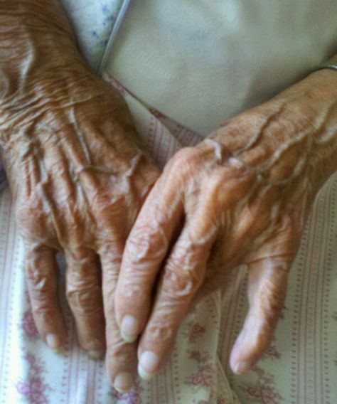 Hands say so much about ones life... this 95 year old woman has taught me so much Wrinkles Hands, Hand Photography, Old Person, Old Hands, Wrinkled Skin, Old Woman, Ap Art, Old Age, Art Poses