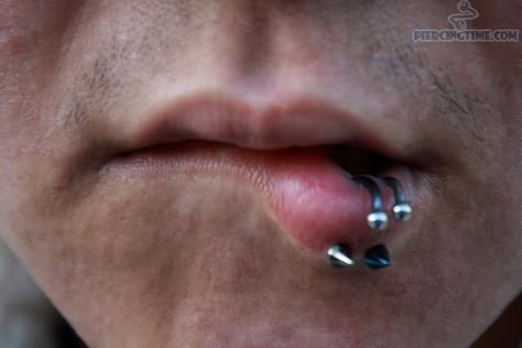 100+ Spider Bites Piercing Examples, Jewelry and Information cool  Check more at http://fabulousdesign.net/spider-bites-piercing/ Spider Piercing, Spider Bites Piercing, Spider Bite Piercing, Spider Bites, Lip Piercing, Nostril Hoop Ring, Piercings, Nose Ring