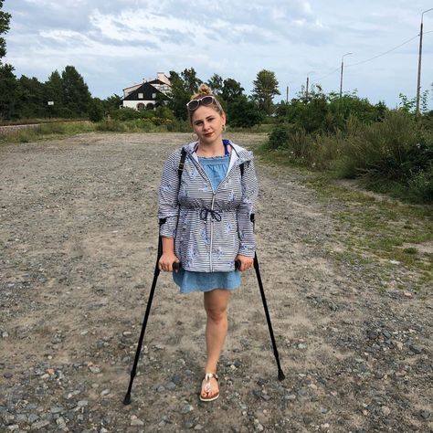 Birkenstock Girl, Leg Amputee, Amputee Model, Disabled Women, Bionic Woman, Crutches, Summer Memories, Birkenstock