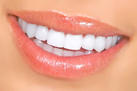 Affirmation: My teeth are straight, pearly white, strong, clean & healthy. Whiten Whites, Kedokteran Gigi, Teeth Whitening Remedies, Laser Teeth Whitening, Yellow Teeth, Teeth Whitening Strips, Best Teeth Whitening, Natural Teeth Whitening, Natural Teeth