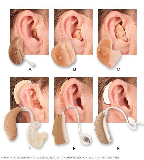 Swimmers Ear Remedy, Throat Anatomy, Audiology Student, Swimmers Ear, Portugal Art, Auditory Processing Disorder, Speech And Hearing, Cold Or Allergies, Auditory Processing