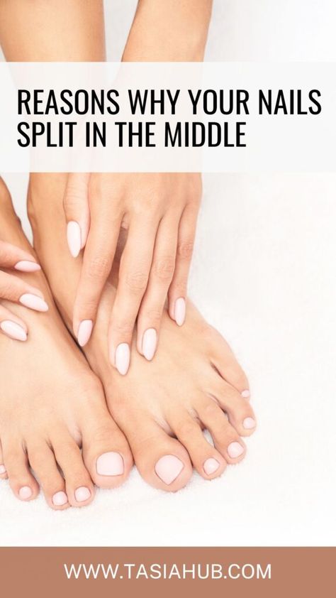 Split Toenail, Nail Remedies, Split Nails, Nail Picking, Ingrown Nail, Nails Now, Ingrown Toe Nail, Dry Nails, Strong Nails