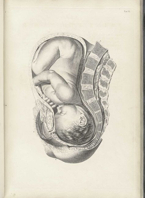 Table 20 of William Smellie's A sett of anatomical tables, with explanations, and an abridgment, of the practice of midwifery, 1754, featuring the illustrated drawing of a woman's uterus with a fetus resting against the spine. Medical Drawings, Birth Art, Map Room, Pregnancy Art, Belly Painting, Print Map, Baby Images, Medical Art, Anatomy Drawing