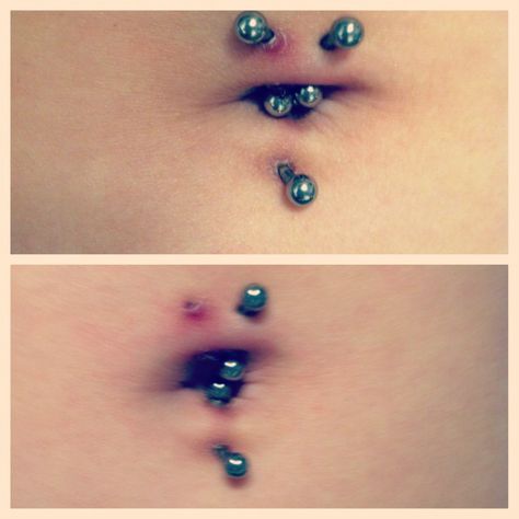 #bellybutton #rejected #infected #piercings Rejecting Piercing, Infected Piercing, Tokyo Ghoul Quotes, Ghoul Quotes, Body Modifications, Belly Button, Tokyo Ghoul, Belly Button Rings, Piercings