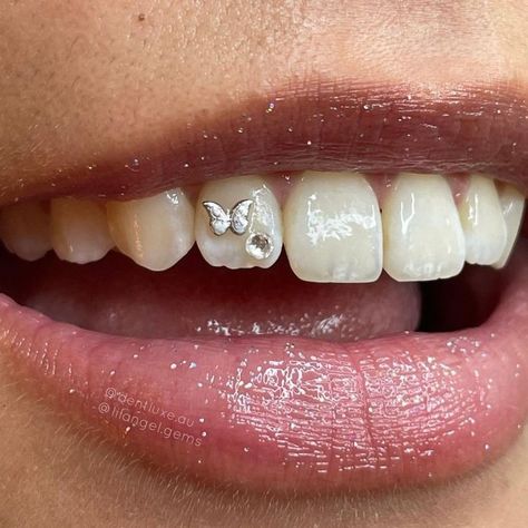 Tooth Gem Placement, Gem Butterfly, Teeth Gems, Pretty Teeth, Dental Jewelry, Gold Tooth, Grillz Teeth, Gem Tattoo, Diamond Teeth