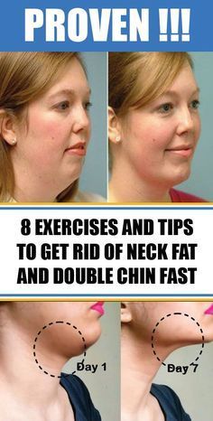 Neck Fat Exercises, Double Chin Exercises, Chin Exercises, Face Yoga Exercises, Face Yoga Facial Exercises, Neck Exercises, Facial Yoga, Face Exercises, Facial Exercises