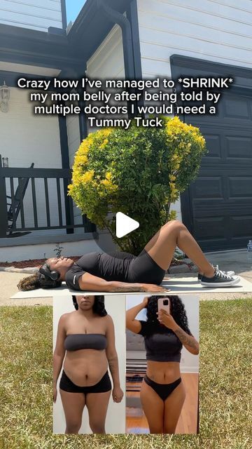 Mom Belly, Diastasis Recti, Tummy Tucks, 3 Kids, Healthcare System, Hidden Gem, Glow Up?, No Way, Belly Fat