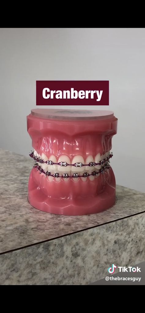 Red Braces Teeth, Red And Black Braces, Burgundy Braces, Braces Hacks, Brace Colors, Power Chain Braces, Braces Colours, Braces Transformation, Dental Braces Colors