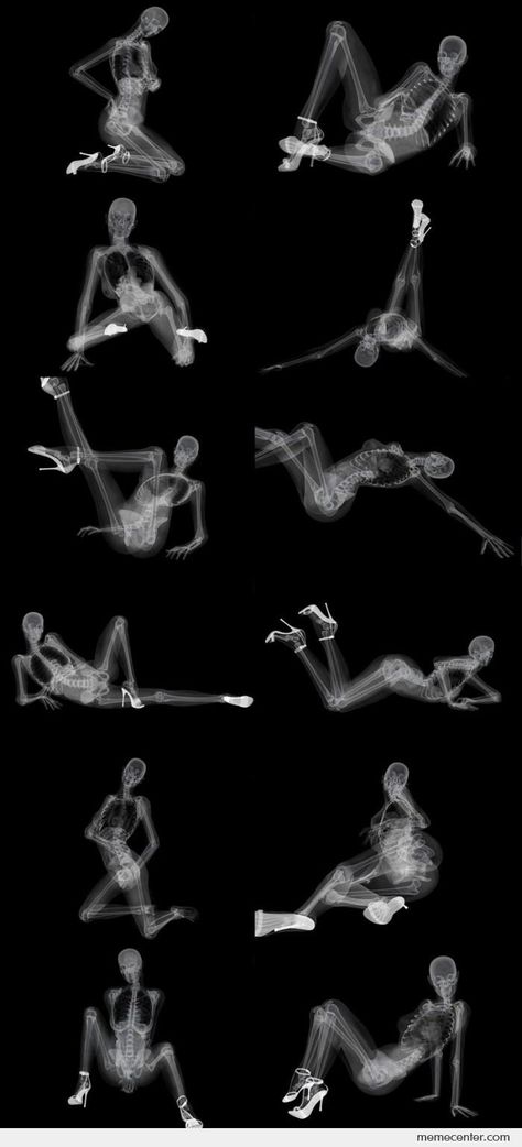 Funny X Ray Pics, Dawg In Me X-ray, X Ray Drawing, X Ray Aesthetic, X Ray Art, Xray Art, X-ray Images, Xray Tech, X Rays