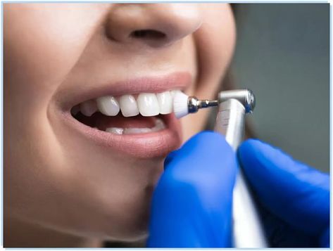 Teeth Cleaning Tooth Scaling, Deep Cleaning Teeth, Dental Scaling, Deep Teeth Cleaning, Dental Sealants, Teeth Whitening Methods, Nose Surgery, Dental Veneers, Dental Crowns