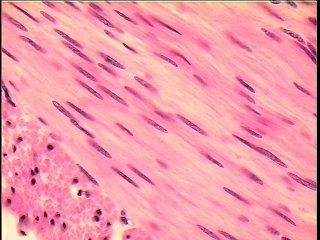 smooth muscle in longitudinal and cross-section. Tissue Biology, Smooth Muscle Tissue, Histology Slides, Smooth Muscle, Types Of Muscles, Cells And Tissues, Tissue Types, Organ System, Medical School Motivation