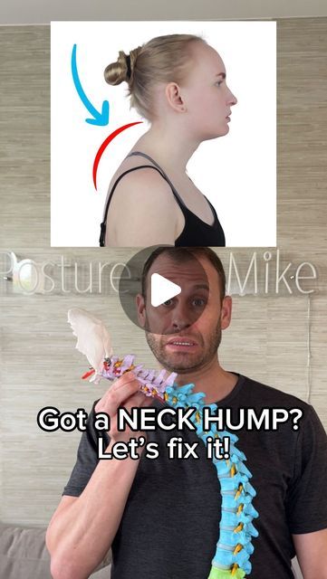 Neck Hump Correction, Hump Correction, Dowager Hump, Back Hump, Dowager's Hump, Neck Hump, My Humps, Posture Fix, Back Stretching