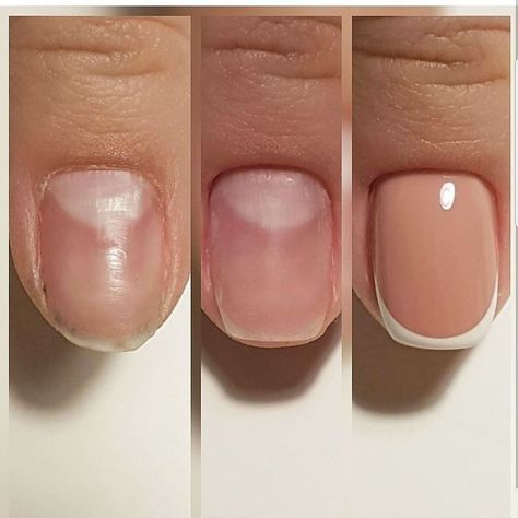 Nails Round, Acrylic Nail Shapes, Nail Techniques, Amazing Nails, Pinterest Nails, How To Grow Nails, Nail Tip, Nail Colours, Striped Nails