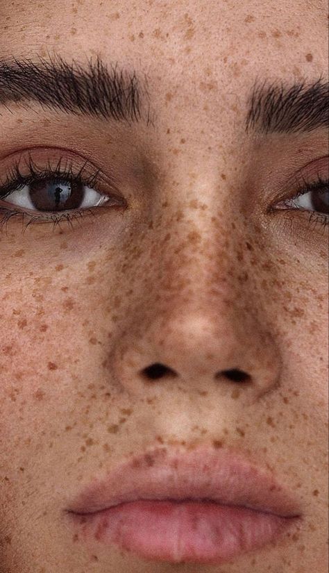 Makeup That Shows Freckles, Full Face Freckles, Olive Skin Freckles, Freckles Aesthetic Faceless, Freckles Across Nose, Arm Freckles, Lip Freckles, Freckles On Nose, Face With Freckles