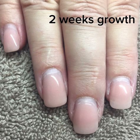 2 weeks growth. Grown Out Gel Nails, Nail Falling Off, Grow Long Nails, Opal Nails, Spring Acrylic Nails, Hard Nails, Nail Time, Dip Nails, Damaged Nails