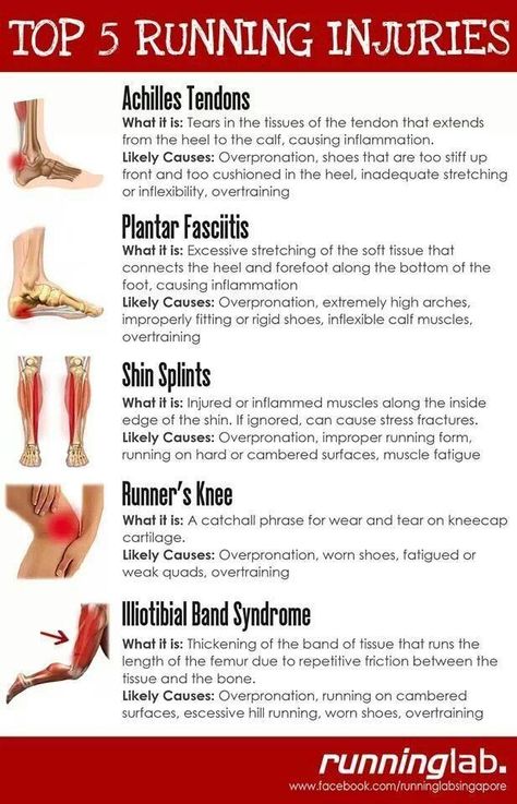 Workouts For Runners, Runners Knee, Runner Problems, Cross Training Workouts, Half Marathon Training Plan, Running Injuries, Training Workouts, Sports Massage, Shin Splints