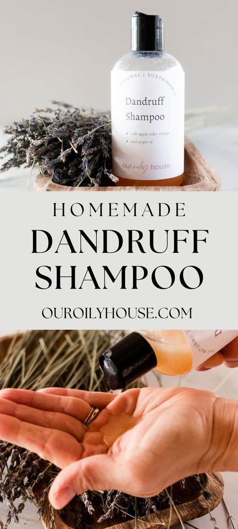 Our Oily House, Natural Shampoo Diy, How To Make Shampoo, Diy Shampoo Recipe, Natural Dandruff Remedy, Best Hair Conditioner, Oils For Dandruff, Diy Conditioner, Baking Soda For Hair