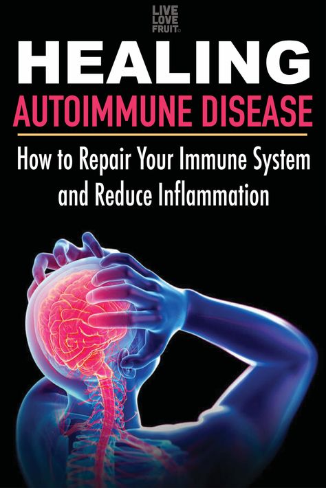 Healing autoimmune disease requires taking a good look at your diet and lifestyle - something Western medicine never considers.  via @livelovefruit Fruit Health, Auto Immune, Coconut Health Benefits, Western Medicine, Body Wrap, Thyroid Health, Ginger Ale, Autoimmune Disease, Health Info