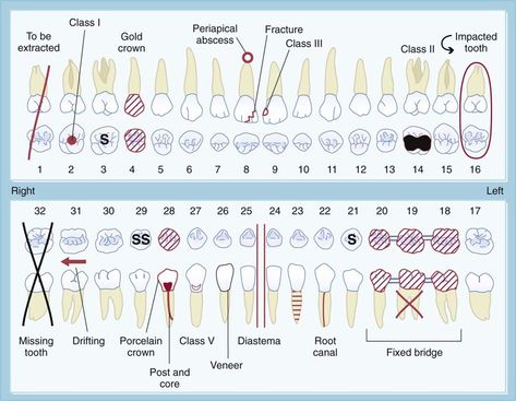 12. The Dental Examination | Pocket Dentistry Dental Assistant Study Guide, Dental Charting, Dental Terminology, Dental Assistant School, Dental Hygienist School, Tooth Implant, Dental Assistant Study, Medical Items, Dental Hygiene Student