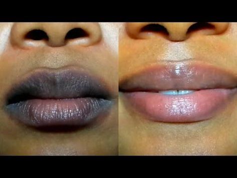 HOW TO LIGHTEN DARK LIPS NATURALLY /Fast Result/ GET PINK LIPS IN 2 DAYS Lipstick For Dark Lips, Remedies For Dark Lips, Lighten Dark Lips, For Dark Lips, Pink Lips Art, Natural Pink Lips, Lip Lightening, Bright Pink Lips, Light Pink Lips