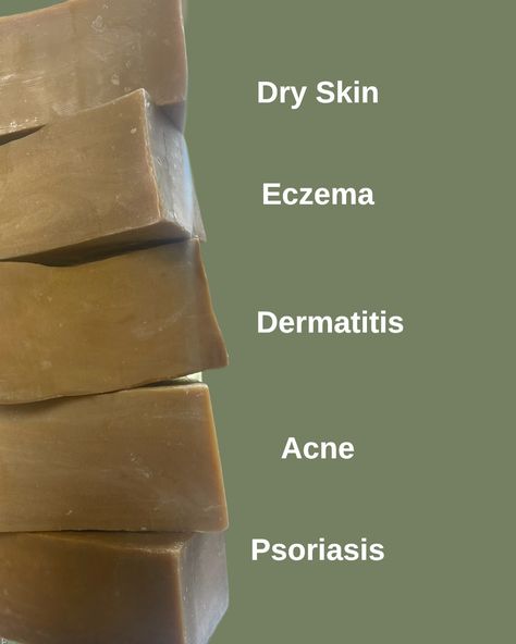 Thanks to its soothing properties, antiseptics and disinfectants, Aleppo soap treats the acne problems, eczema, of psoriasis or of dermatosis.. Acne : Aleppo soap containing laurel oil has antiseptic properties. It blocks the proliferation of bacteria responsible for dermatological problems when suffering from acne. It unclogs pores and eliminates the sebum responsible for blackheads and pimples on your skin. Eczema, psoriasis or dermatosis : Aleppo soap brings comfort to your skin. #amazon... Aleppo Soap, For Blackheads, Acne Problem, Luxury Soap, Unclog Pores, Blackheads, Soap, Acne, Skin