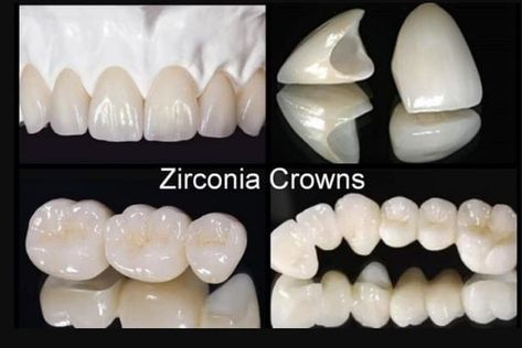 Zirconia crowns are made from zirconium dioxide, a very durable type of ceramic material. Zirconia dental crown benefits. Crowns made of ... #dentallab #odontologia #dentist #teeth #dentista #dentistry #dental #odonto #tooth #teethwhitening #orthodontics #dentistas #veneers #dentalcare #cosmeticdentistry #zirconia #oralhealth #smilemakeover #dentalhygienist #dentalclinic #dentalimplants Dental Ceramics, Muharram Wallpaper, Tooth Crown, Dentist Teeth, Dental Restoration, Dental Videos, Dental Fun, Dental Fillings, Brain Art