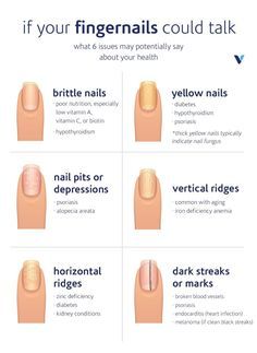 Often, our hair, skin, and nails reflect our interior health. Here are six common fingernail issues—and what they’re trying to tell you about your health. Nail Health Signs, Fingernail Health, Emerald Nails, Opal Nails, Health Signs, Nail Bed, Peinados Recogidos, Brittle Nails, Nail Growth