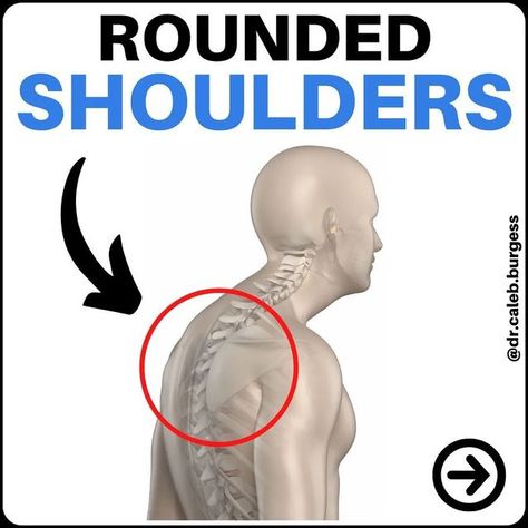 Back Pain | Neck Pain | Relief on Instagram: "💥Rounded Shoulders💥 Follow @endbackpain for more! By @dr.caleb.burgess ❤️ TAG or SHARE this post with someone who needs to see this! 😱 "Rounded shoulders" posture gets a lot of bad press on the internet, and it's usually explained very poorly 🔍 Search "Rounded Shoulders" on Google and you'll spend all day scrolling through "Fixes", "Posture Corrections", and endless before and after ✅❌ "comparison" photos 💯 But here's the deal: Specific postural Upper Back Pain Exercises, Yoga Before Bed, Changing Yourself, Shoulder Posture, Middle Back Pain, Rounded Shoulders, Sciatica Exercises, Back Stretches For Pain, Lower Back Pain Exercises