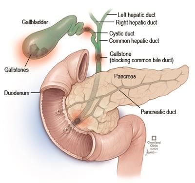 Human Skeleton Anatomy, Gallbladder Surgery, Signs Of Inflammation, Referred Pain, Liver Issues, Abnormal Cells, Bile Duct, Abdominal Pain, Medical Information