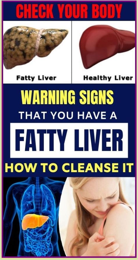 CHECK YOUR BODY: Warning Signs That You Have a Fatty Liver Ways and How to Cleanse It Quadrants Of The Abdomen, Itching Skin, Healthy Liver, Upset Stomach, Body Organs, Digestion Problems, Warning Signs, Home Remedies, Health Tips