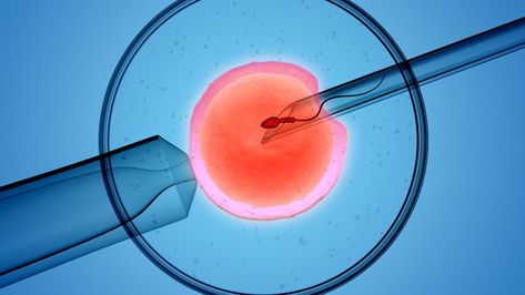 Monash IVF will likely call on expert embryologists to defend claims it incorrectly destroyed viable embryos, ending some women’s hopes of having children, a court has been told. Organizational Development, Ivf Cost, Forms Of Birth Control, Assisted Reproductive Technology, Ivf Baby, Ivf Clinic, Fertility Center, In Vitro Fertilization, Global Health