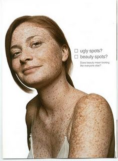 Dove Campaign for REAL Beauty: freckles. are. beautiful. <3 Real Beauty Campaign, Dove Campaign, Dove Real Beauty, Freckle Remover, Beautiful Freckles, Freckle Face, Beauty Spot, We Are The World, Real Beauty