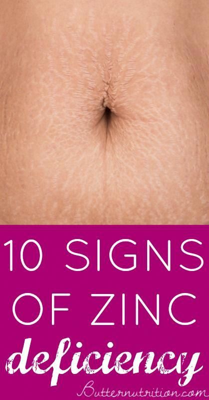 10 Signs of Zinc Deficiency | Butter Nutrition Zinc Benefits, Loss Of Appetite, Zinc Supplements, Low Estrogen Symptoms, Zinc Deficiency, Too Much Estrogen, Low Estrogen, Vitamin Deficiency, Magnesium Deficiency