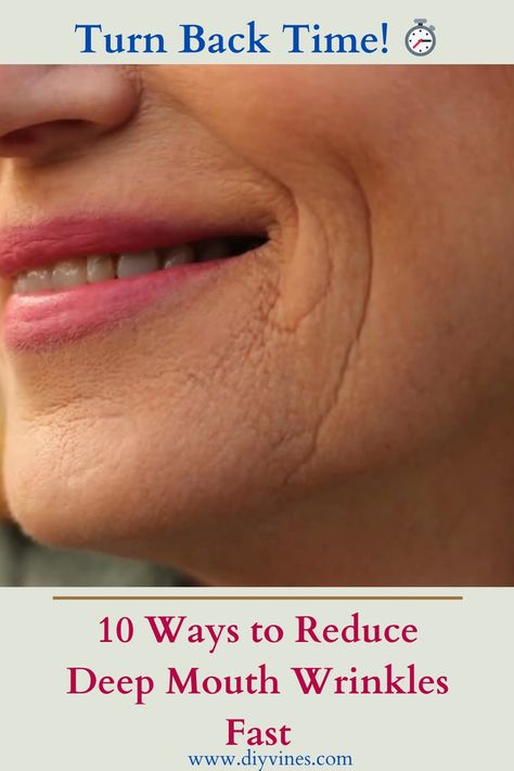 10 Ways to Reduce Deep Mouth Wrinkles Fast Deep Wrinkles Around Mouth, How To Get Rid Of Frown Lines By Mouth, Dry Mouth Remedies How To Get Rid, How To Get Rid Of Wrinkles, Frown Lines Around Mouth, Wrinkles Around Mouth, Lines Around Mouth, Upper Lip Wrinkles, Cheek Wrinkles