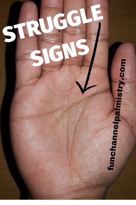 The article explains about different struggle and obstacle signs such as multiple islands on the head line,stress lines on the hands,star on the mount of Saturn,island on the life line etc etc and its interpretations. Hand Lines Meaning, Palm Reading Lines, Palm Reading Charts, Bad Signs, Palmistry Reading, Yoga Information, Sweaty Hands, Jyotish Astrology, Health Podcast