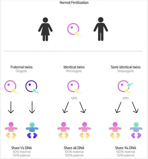 A diagram illustrating the different types of twins Types Of Twins, Pregnant With Boy, Development Milestones, Fraternal Twins, Dna Genealogy, Medicine Journal, Genetic Testing, Expecting Twins, Human Anatomy And Physiology