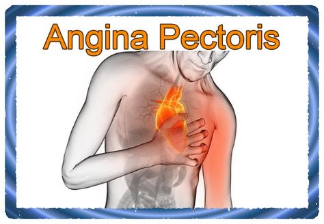 Sinus Massage, Programming Projects, Software Programming, About Computer, Angina Pectoris, Computer Training, Beta Blockers, Coronary Arteries, Heart Conditions