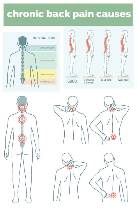 For millions of people around the globe, back pain is an all too common occurrence. Studies have shown that up to 80% of the population will experience some form of back pain at some point in their life. Back pain also tops the chart for the most common causes of work-related injuries and, as a result, is the second highest cause for missed workdays. One study conducted by the Bone and Joint Initiative found that back pain accounted for more than 264 million lost workdays in 2018 alone. Back Spasm, Chronic Back Pain, Medical Animation, Healing Thoughts, Medical School Studying, Low Back Pain, The Bone, Sciatica, Medical School