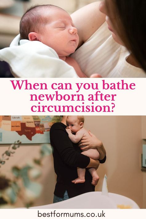 When Can you Bathe Newborn After Circumcision? When To Bathe Newborn, Circumcision Care Newborn, When To Clean, Newborn Stuff, Mum Quotes, Strong Willed Child, Baby Gift Guide, Better Communication, Delivering A Baby